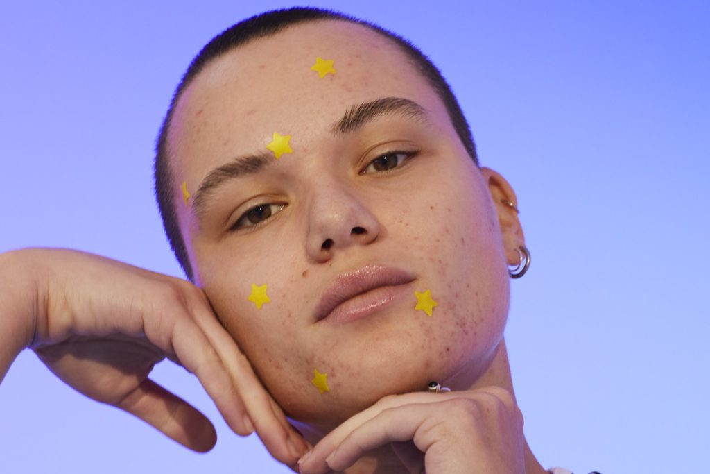 star pimple patches